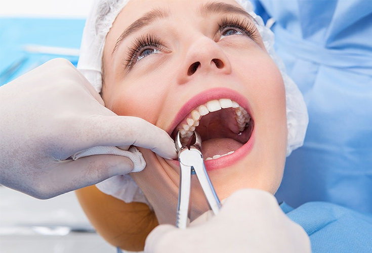 Complicated Extractions in Dubai