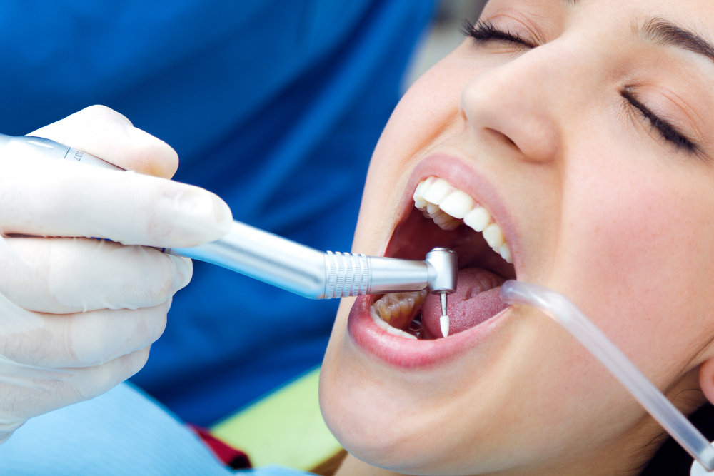 Root Canal or Implant in Dubai